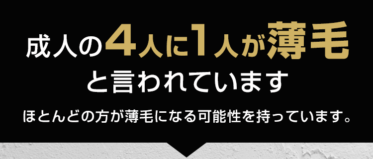 あなたは薄毛になる原因をご存知ですか?